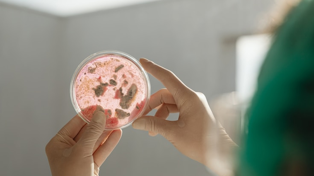 Händer med handskar håller en petriskål med rosa och mörka bakteriekolonier.